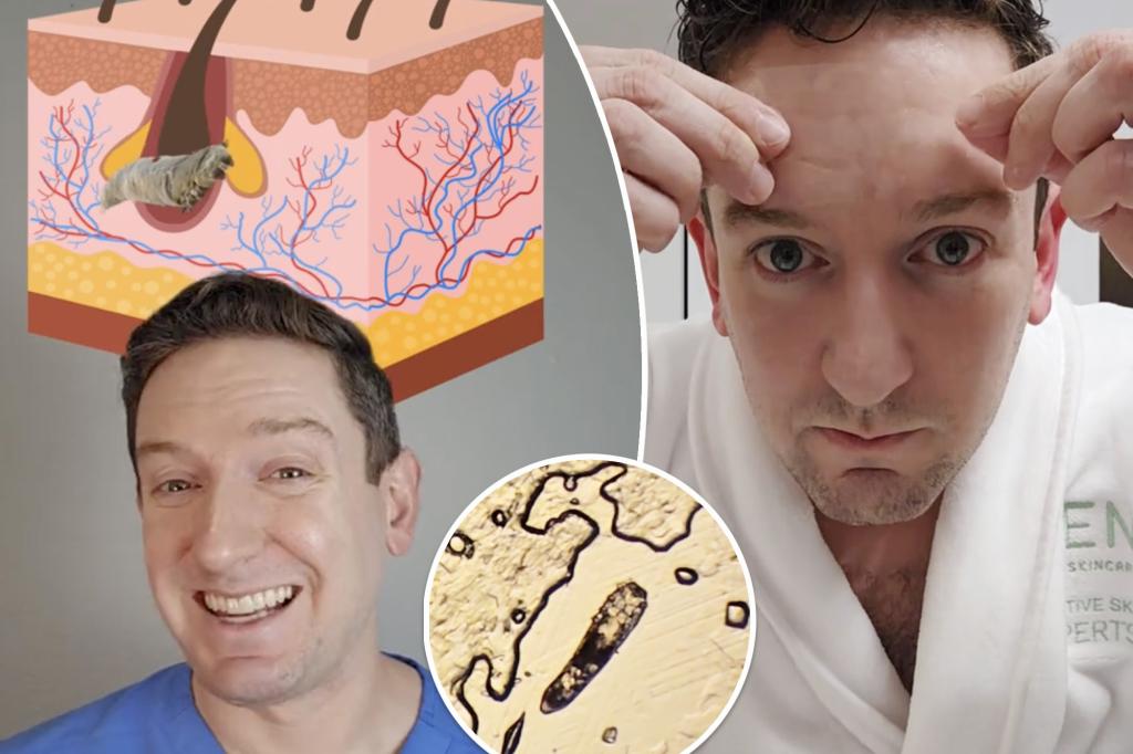 I'm a doctor - here's how to tell if you have mites mating on your face